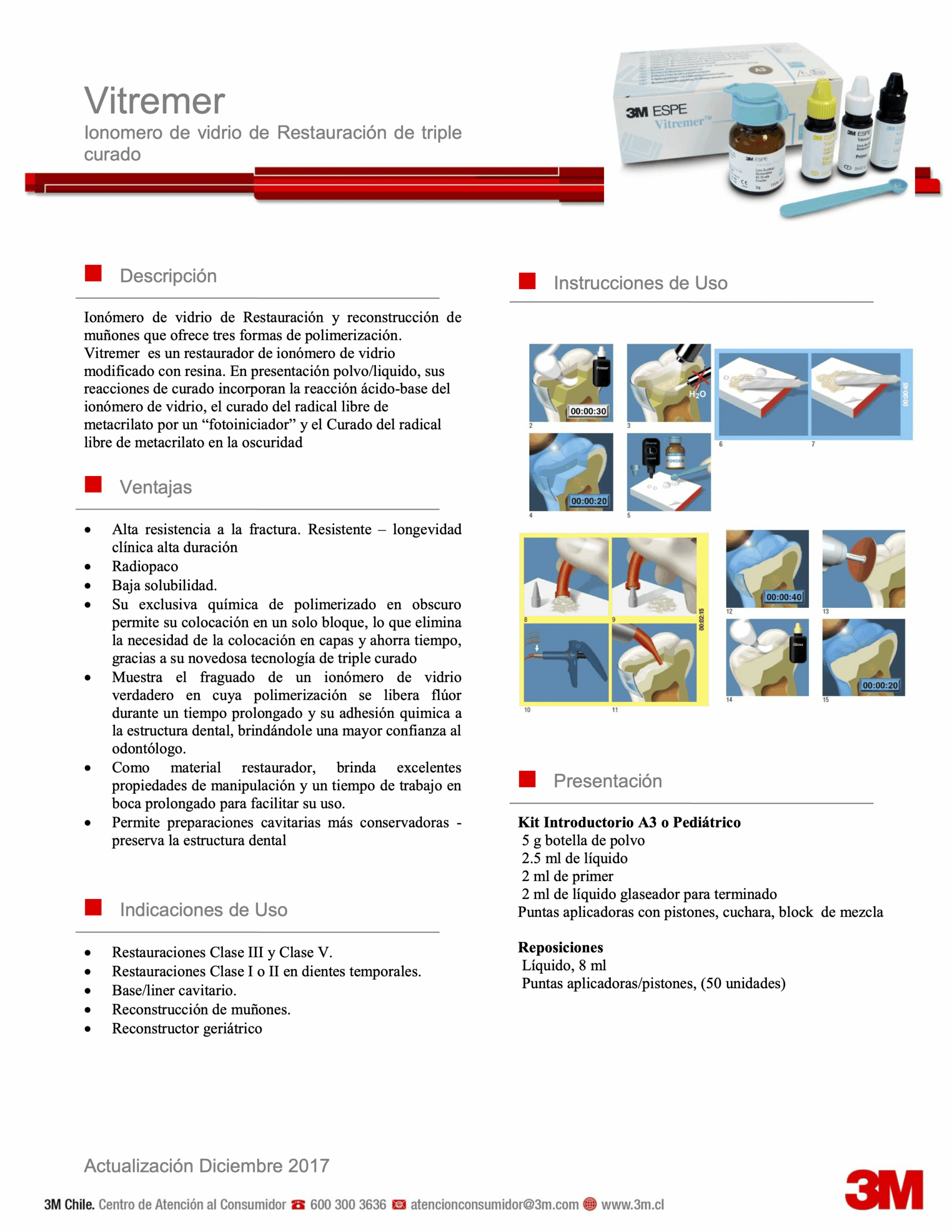 Vidrio Ionómero Vitremer A3 Set Fotocurado - 3M